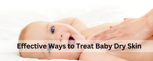 Effective Ways to Treat Baby Skin