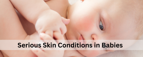 Serious Skin Conditions in Babies