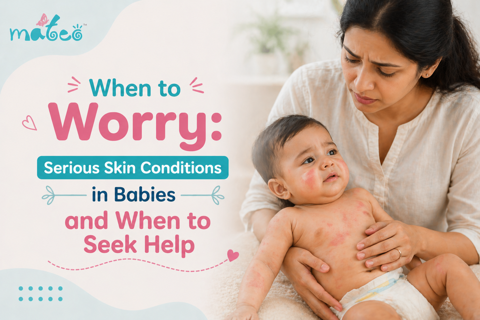 When to Worry Serious Skin Conditions in Babies and When to Seek Help