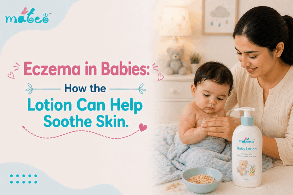 Eczema in Babies How the Lotion Can Help Soothe Skin.
