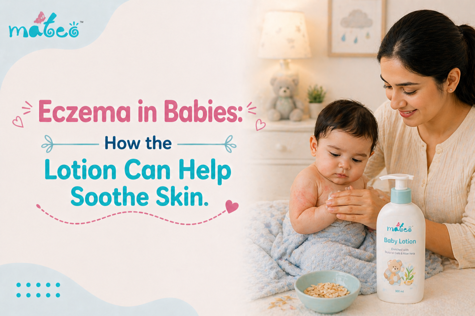 Eczema in Babies How the Lotion Can Help Soothe Skin.